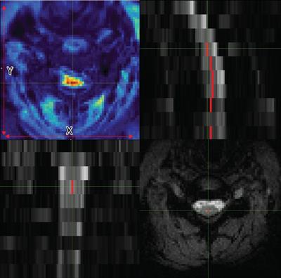 DeepRetroMoCo: deep neural network-based retrospective motion correction algorithm for spinal cord functional MRI